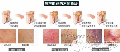 韦神门牙脱落原因及治疗方案对比分析
